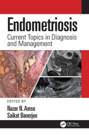 Endometriosis: Current Topics in Diagnosis and Management book cover