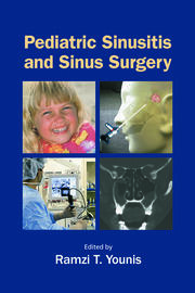 Pediatric Sinusitis and Sinus Surgery book cover