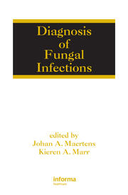 Diagnosis of Fungal Infections book cover