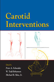 Carotid Interventions book cover