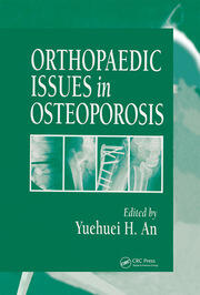 Orthopaedic Issues in Osteoporosis book cover