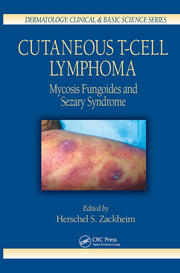 Cutaneous T-Cell Lymphoma: Mycosis Fungoides and Sezary Syndrome book cover