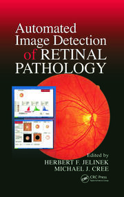 Automated Image Detection of Retinal Pathology book cover
