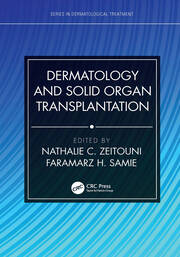 Dermatology and Solid Organ Transplantation book cover