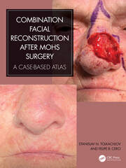 Combination Facial Reconstruction after Mohs Surgery: A Case Based Atlas book cover