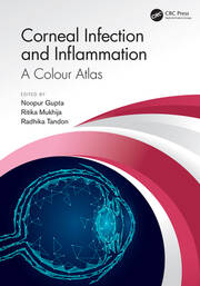 Corneal Infection and Inflammation: A Colour Atlas book cover