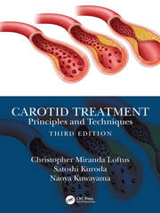 Carotid Treatment: Principles and Techniques book cover