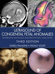 Ultrasound of Congenital Fetal Anomalies: Differential Diagnosis and Prognostic Indicators book cover