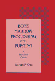 Bone Marrow Processing and Purging: a Practical Guide book cover