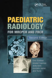 Paediatric Radiology for MRCPCH and FRCR, Second Edition book cover