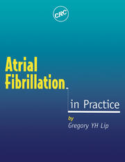 Atrial Fibrillation in Practice book cover