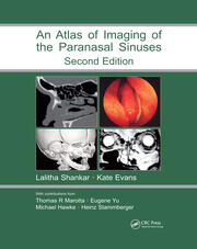 Atlas of Imaging of the Paranasal Sinuses, Second Edition book cover