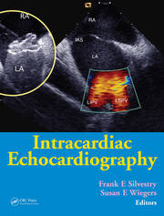 Intracardiac Echocardiography book cover