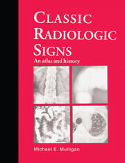 Classic Radiologic Signs: An Atlas and History book cover