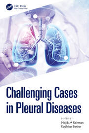 Challenging Cases in Pleural Diseases book cover