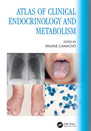 Atlas of Clinical Endocrinology and Metabolism book cover