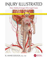 Injury Illustrated: How Medical Images Win Legal Cases book cover