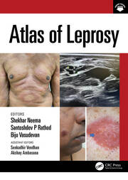 Atlas of Leprosy book cover