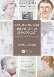 Skin Disease and the History of Dermatology: Order out of Chaos book cover