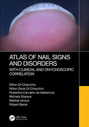 Atlas of Nail Signs and Disorders with Clinical and Onychoscopic Correlation book cover