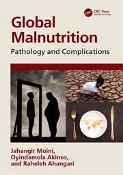 Global Malnutrition: Pathology and Complications book cover