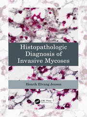 Histopathologic Diagnosis of Invasive Mycoses book cover