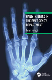 Hand Injuries in the Emergency Department book cover