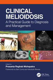 Clinical Melioidosis: A Practical Guide to Diagnosis and Management book cover