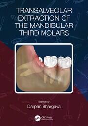 Transalveolar Extraction of the Mandibular Third Molars book cover