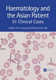 Haematology and the Asian Patient: 51 Clinical Cases book cover