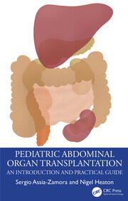 Pediatric Abdominal Organ Transplantation: An Introduction and Practical guide book cover