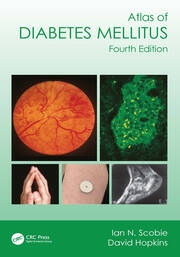 Atlas of Diabetes Mellitus book cover