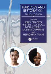Hair Loss and Restoration book cover
