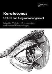 Keratoconus: Optical and Surgical Management book cover