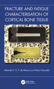 Fracture and Fatigue Characterisation of Cortical Bone Tissue book cover