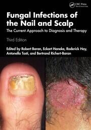 Fungal Infections of the Nail and Scalp: The Current Approach to Diagnosis and Therapy book cover