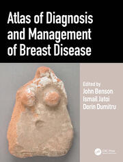 Atlas of Diagnosis and Management of Breast Disease book cover