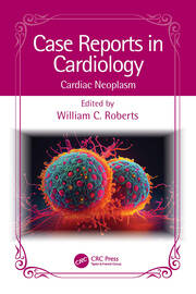Case Reports in Cardiology: Cardiac Neoplasm book cover