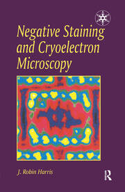 Negative Staining and Cryoelectron Microscopy: The Thin Film Techniques book cover