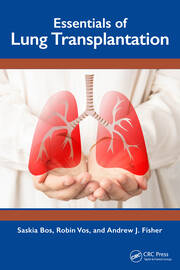 Essentials of Lung Transplantation book cover