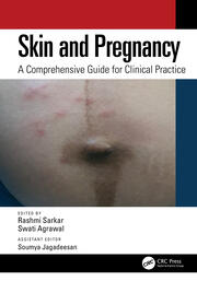 Skin and Pregnancy: A Comprehensive Guide for Clinical Practice book cover