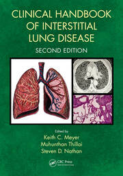 Clinical Handbook of Interstitial Lung Disease book cover