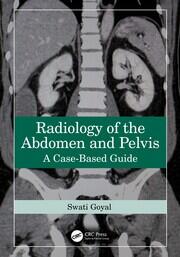 Radiology of the Abdomen and Pelvis: A Case-Based Guide book cover