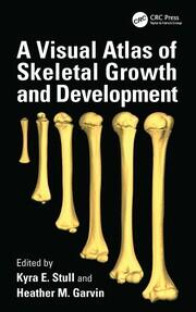 A Visual Atlas of Skeletal Growth and Development book cover