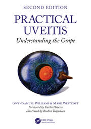 Practical Uveitis: Understanding the Grape book cover