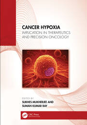 Cancer Hypoxia: Implication in Therapeutics and Precision Oncology book cover