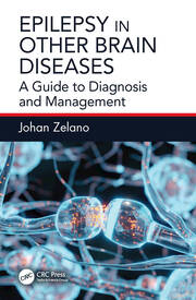 Epilepsy in Other Brain Diseases: A Guide to Diagnosis and Management book cover