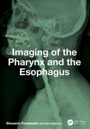 Imaging of the Pharynx and the Esophagus book cover