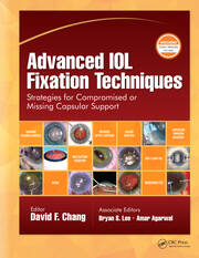 Advanced IOL Fixation Techniques: Strategies for Compromised or Missing Capsular Support book cover
