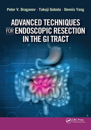 Advanced Techniques for Endoscopic Resection in the GI Tract book cover